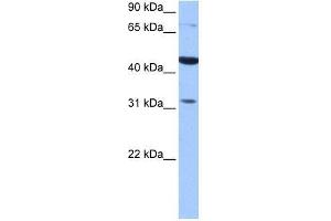 TPRXL antibody used at 0. (TPRXL Antikörper  (C-Term))