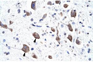 Immunohistochemistry (IHC) image for anti-Chloride Channel 3 (CLCN3) (C-Term) antibody (ABIN2776327)