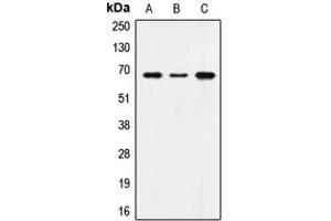 Western blot analysis of SNX1 expression in MCF7 (A), SP2/0 (B), H9C2 (C) whole cell lysates. (Sorting Nexin 1 Antikörper  (Center))