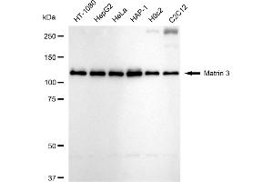 Western blotting analysis using Matrin 3 antibody (ABIN7799337). (Rekombinanter MATR3 Antikörper)