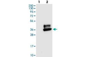 Western blot analysis of Lane 1: Negative control (vector only transfected HEK293T lysate), Lane 2: Over-expression Lysate (Co-expressed with a C-terminal myc-DDK tag (~3. (CEACAM1 Antikörper)
