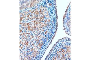 Immunohistochemistry (IHC) image for anti-T-Cell, Immune Regulator 1, ATPase, H+ Transporting, Lysosomal V0 Subunit A3 (TCIRG1) (AA 1-130) antibody (ABIN7270707)