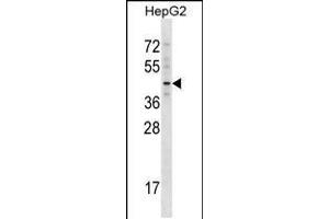 Western blot analysis in HepG2 cell line lysates (35ug/lane). (TBX20 Antikörper  (C-Term))