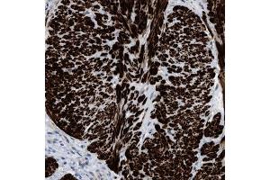 Immunohistochemical staining (Formalin-fixed paraffin-embedded sections) of human gallbladder shows strong cytoplasmic positivity in smooth muscle cells. (Transgelin Antikörper  (AA 19-94))