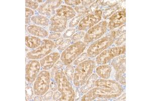 Immunohistochemistry of paraffin-embedded mouse kidney using NDUFS1 Rabbit pAb (ABIN7268819) at dilution of 1:50 (40x lens).