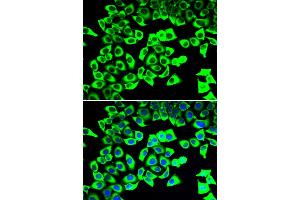 Immunofluorescence analysis of U2OS cells using RPLP2 antibody. (RPLP2 Antikörper)