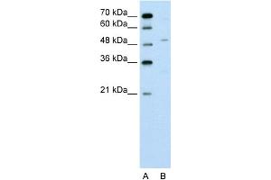 WB Suggested Anti-ZNF19 Antibody Titration:  0. (ZNF19 Antikörper  (N-Term))