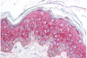 Human Skin (formalin-fixed, paraffin-embedded) stained with AVEN antibody ABIN213902 at 5 ug/ml followed by biotinylated goat anti-rabbit IgG secondary antibody ABIN481713, alkaline phosphatase-streptavidin and chromogen. (AVEN Antikörper  (N-Term))