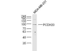 Lane 1: MDA-MB-231 cell lysates probed with 	PCDH20 Polyclonal Antibody, Unconjugated  at 1:300 overnight at 4˚C. (PCDH20 Antikörper  (AA 611-710))