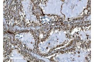 IHC analysis of INPPL1 using anti-INPPL1 antibody (ABIN7599785).