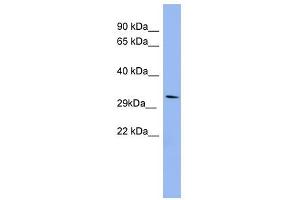 RRAD antibody used at 1 ug/ml to detect target protein. (RRAD Antikörper  (Middle Region))