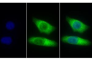 Detection of CTSZ in Human Hela cell using Polyclonal Antibody to Cathepsin Z (CTSZ) (Cathepsin Z Antikörper  (AA 24-303))