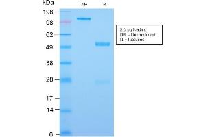 SDS-PAGE Analysis Purified CDX2 Rabbit Recombinant Monoclonal Antibody (CDX2/2951R). (Rekombinanter CDX2 Antikörper  (AA 150-249))