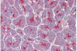 Pancreas, Human: Formalin-Fixed, Paraffin-Embedded (FFPE) (TPCN2 Antikörper  (AA 735-747))
