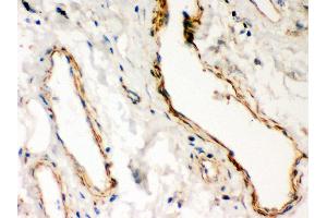 Anti- Dystrophin Picoband antibody, IHC(P) IHC(P): Human Lung Cancer Tissue