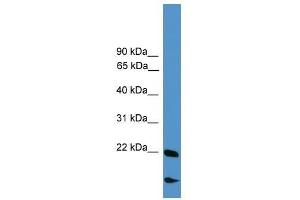 RBM18 antibody used at 0. (RBM18 Antikörper  (Middle Region))