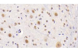 Detection of NCL in Mouse Cerebellum Tissue using Polyclonal Antibody to Nucleolin (NCL) (Nucleolin Antikörper  (AA 353-568))