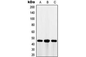 Western blot analysis of MAGEA1 expression in HT29 (A), A375 (B), Jurkat (C) whole cell lysates. (MAGEA1 Antikörper  (C-Term))