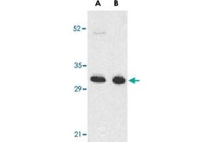 Western blot analysis of TNFRSF13B in K-562 (A) and U-937 (B) cell lysates with TNFRSF13B polyclonal antibody  at 5 ug/mL . (TACI Antikörper  (N-Term))