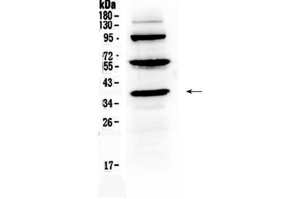 Thrombopoietin Antikörper  (AA 22-259)