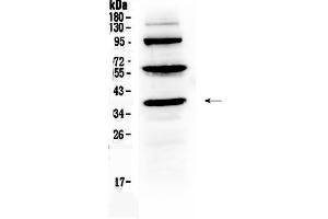 Western blot analysis of Thrombopoietin using anti-Thrombopoietin antibody . (Thrombopoietin Antikörper  (AA 22-259))