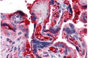 Human Placenta (formalin-fixed, paraffin-embedded) stained with C4B antibody ABIN364282 at 20 ug/ml followed by biotinylated secondary antibody, alkaline phosphatase-streptavidin and chromogen. (C4B Antikörper)