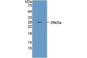 Detection of Recombinant PRSS1, Human using Polyclonal Antibody to Protease, Serine 1 (PRSS1) (PRSS1 Antikörper  (AA 51-228))