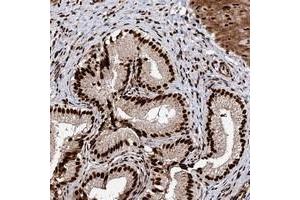 Immunohistochemical staining of human gallbladder with MATR3 polyclonal antibody  shows strong niclear positivity in glandular cells. (MATR3 Antikörper)