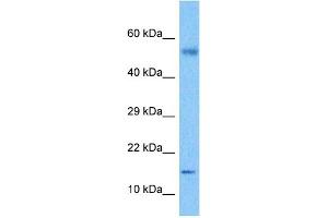 Host:  Rabbit  Target Name:  CSF2  Sample Tissue:  Lymph Node Tumor lysates  Antibody Dilution:  1ug/ml (GM-CSF Antikörper  (C-Term))