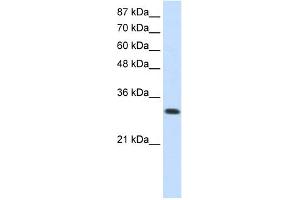 WB Suggested Anti-SCYE1 Antibody Titration:  0. (AIMP1 Antikörper  (N-Term))