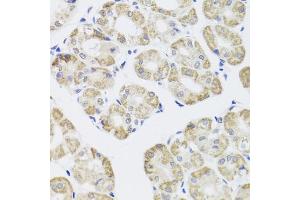 Immunohistochemistry of paraffin-embedded human stomach using PPP1CC antibody. (PPP1CC Antikörper)