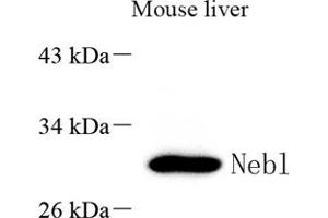Western blot analysis of Nebulette (ABIN7074788) at dilution of 1: 2000 (Nebulette Antikörper)