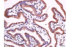 Immunohistochemistry (Paraffin-embedded Sections) (IHC (p)) image for anti-Hydroxyprostaglandin Dehydrogenase 15-(NAD) (HPGD) (AA 55-160) antibody (ABIN761711)