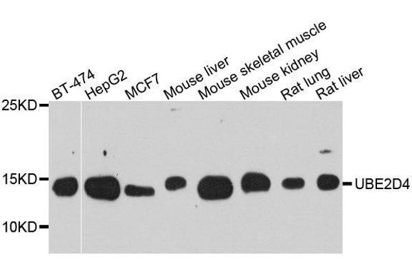 UBE2D4 Antikörper  (AA 1-147)