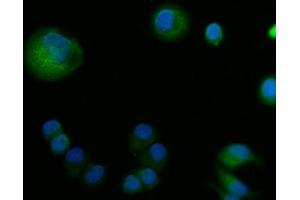 IF analysis of ABP1/AOC1 using anti-ABP1/AOC1 antibody (ABIN4886460).