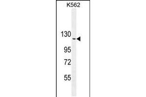 Western blot analysis in K562 cell line lysates (35ug/lane). (ARHGAP17 Antikörper  (N-Term))