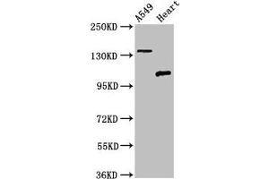 Western Blot Positive WB detected in: A549 whole cell lysate, Rat heart tissue All lanes: ADGRA2 antibody at 3 μg/mL Secondary Goat polyclonal to rabbit IgG at 1/50000 dilution Predicted band size: 143, 120, 20 kDa Observed band size: 143, 120 kDa (GPR124 Antikörper  (AA 1069-1338))
