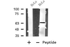 Western blot analysis of extracts from HeLa cells, using IL4I1 antibody. (IL4I1 Antikörper  (N-Term))