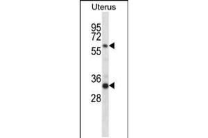 Western blot analysis in human normal Uterus tissue lysates (35ug/lane). (Fam172a Antikörper  (AA 203-232))