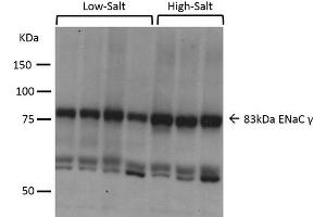 Western blot analysis of Mouse kidney cortex showing detection of ENaC protein using Rabbit Anti-ENaC Polyclonal Antibody . (SCNN1A Antikörper  (AA 629-650) (PerCP))