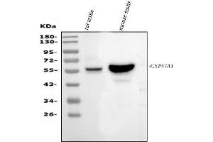 Western blot analysis of Cyp17a1 using anti-Cyp17a1 antibody (ABIN5693094).