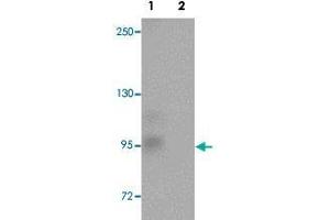 Western blot analysis of rat brain tissue with ZC3H12C polyclonal antibody  at 1 ug/mL in (Lane 1) the absence and (Lane 2) the presence of blocking peptide. (ZC3H12C Antikörper  (N-Term))