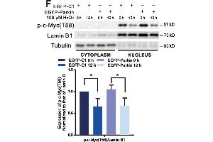 c-Myc is upregulated in H2O2-induced cells. (c-MYC Antikörper  (pThr58))