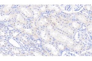 Immunohistochemistry (IHC) image for anti-Caspase 6, Apoptosis-Related Cysteine Peptidase (CASP6) (AA 194-293) antibody (ABIN7437107)
