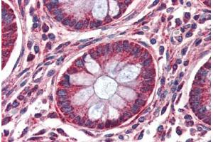 Anti-MMP14 antibody IHC of human colon. (MMP14 Antikörper  (AA 160-173))