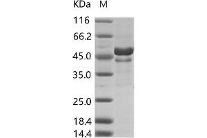 Zika Virus Envelope (ZIKV E) (AA 291-694) protein (His tag)