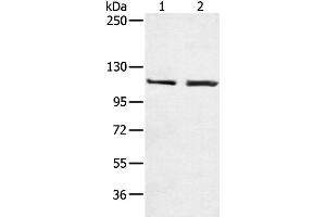Western Blotting (WB) image for anti-Telomerase Reverse Transcriptase (TERT) antibody (ABIN2426079) (TERT Antikörper)
