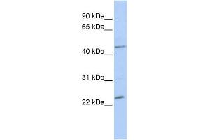 WB Suggested Anti-NKX3-1 Antibody Titration:  0. (NKX3-1 Antikörper  (Middle Region))