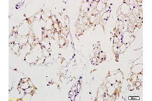 Formalin-fixed and paraffin embedded mouse stomach labeled with Anti-EGFRvIII Polyclonal Antibody, unconjugated  (ABIN742035) at 1: 200 followed by incubation with conjugated secondary antibody and DAB staining (EGFRviii Antikörper  (AA 1-50))