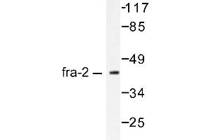 Image no. 1 for anti-FOS-Like Antigen 2 (FOSL2) antibody (ABIN265424) (FOSL2 Antikörper)
